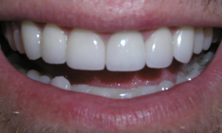 Case-1-After-Image