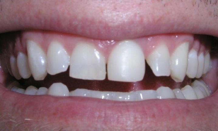 Case-1-Before-Image
