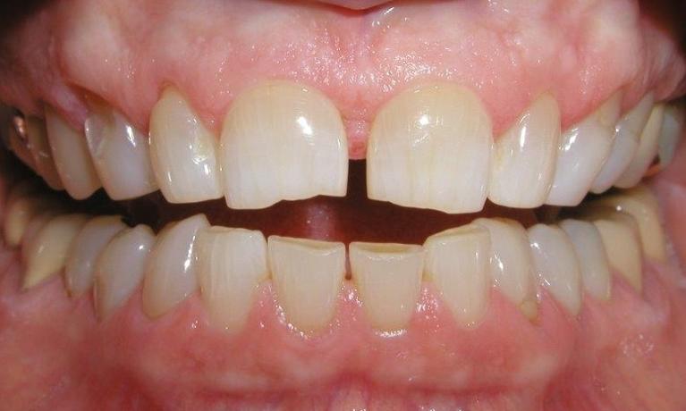 Case-4-Before-Image